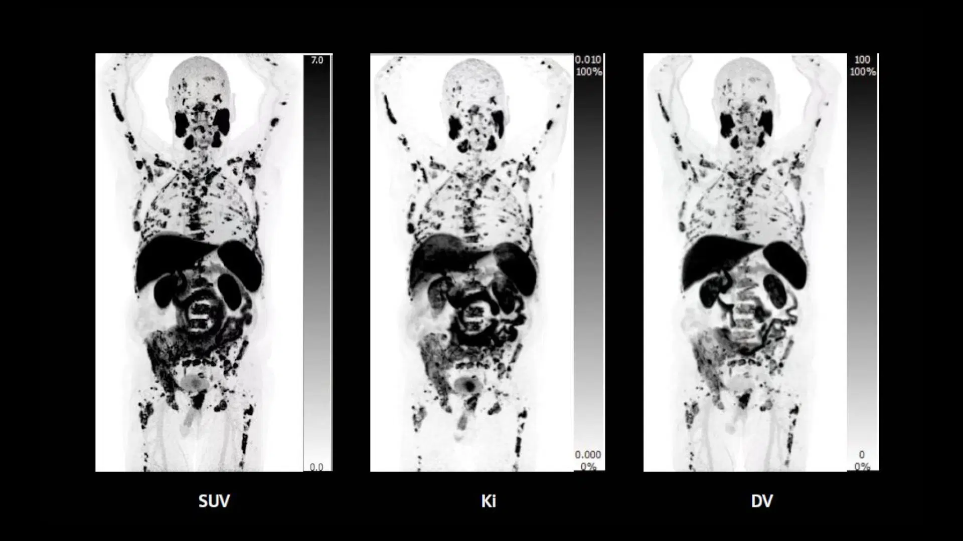 Artificial Life: From Conway’s Game of Life to Modeling the Human Body